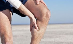varicose veins of the legs in men